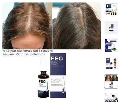 FEG Hair Growth Spray – Natural Hair Restoration for Thicker, Healthier Locks