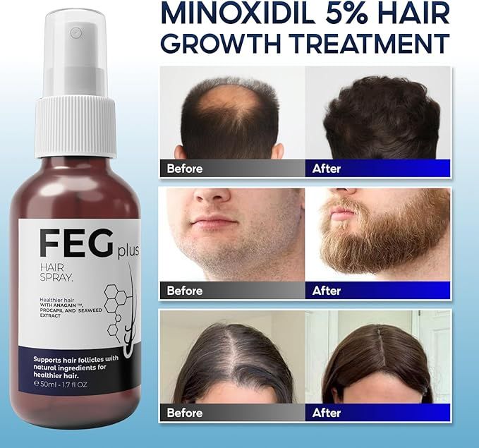 FEG Hair Growth Spray PLUS